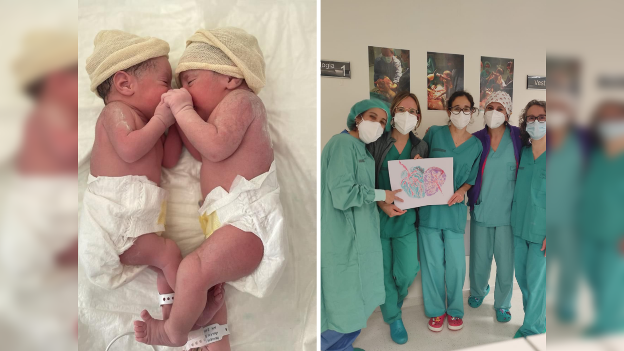 Rare twin birth