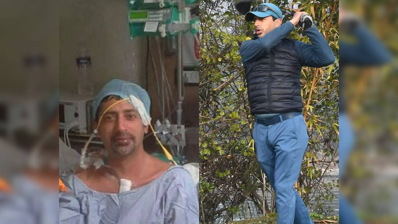 Karhun Nanda before and after his heart transplant surgery