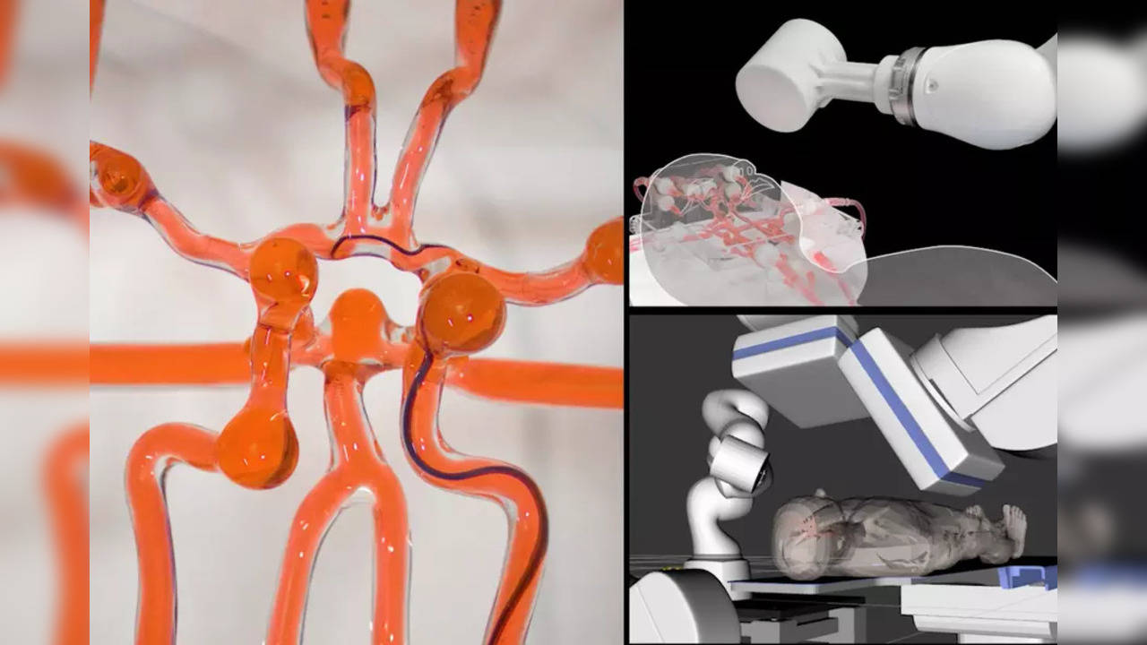 Stroke: Manually controlled robot to help treat strokes and aneurysms remotely - Genius minds at MIT strike again!