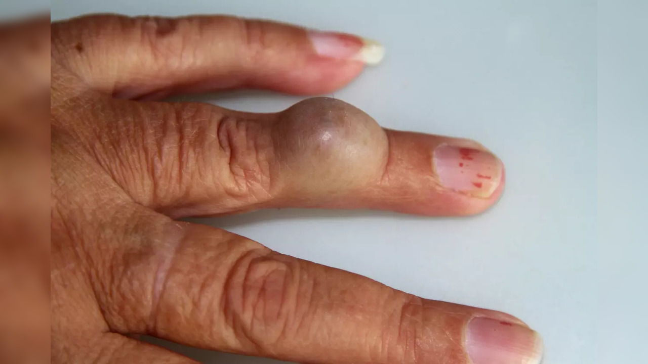 To diagnose osteoarthritis, doctors can run an array of tests initially to rule out the possibility of rheumatoid arthritis and gout as blood tests may not serve the purpose well.