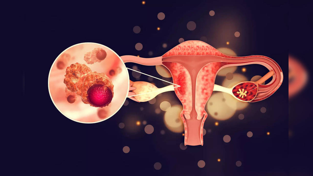 Ovarian cancer signs: Red flags to look out for