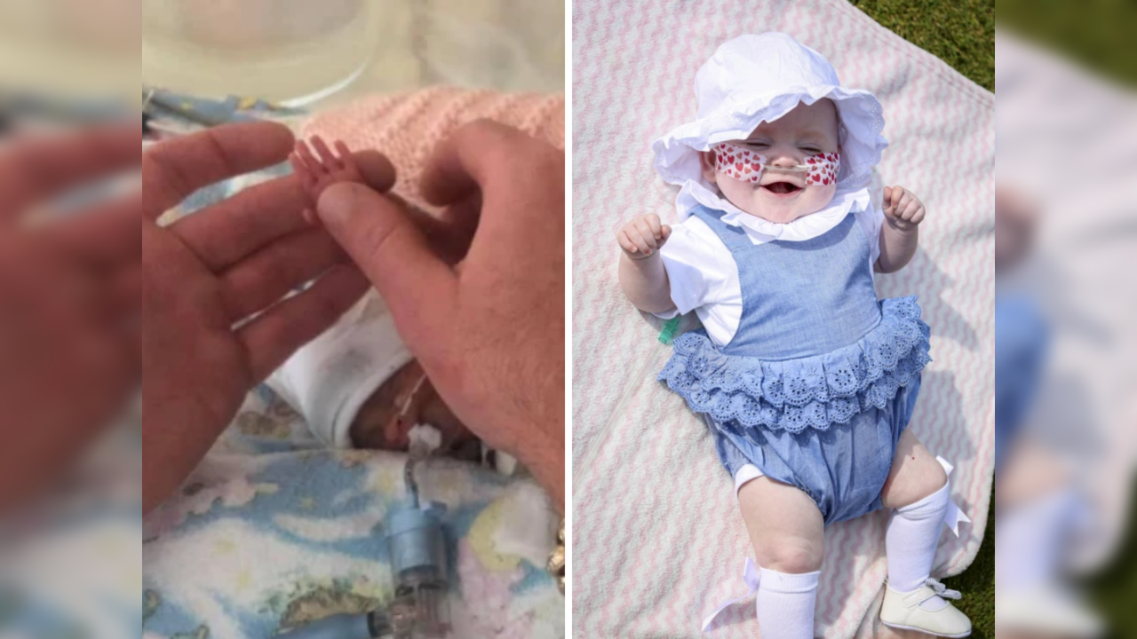 Miracle baby born at 23 weeks