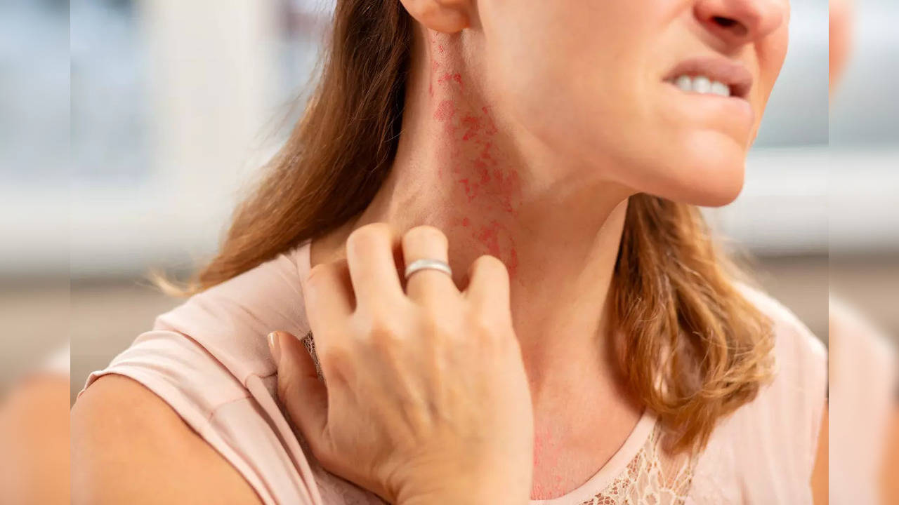 Skin Rash Leads to Shocking Diagnosis 