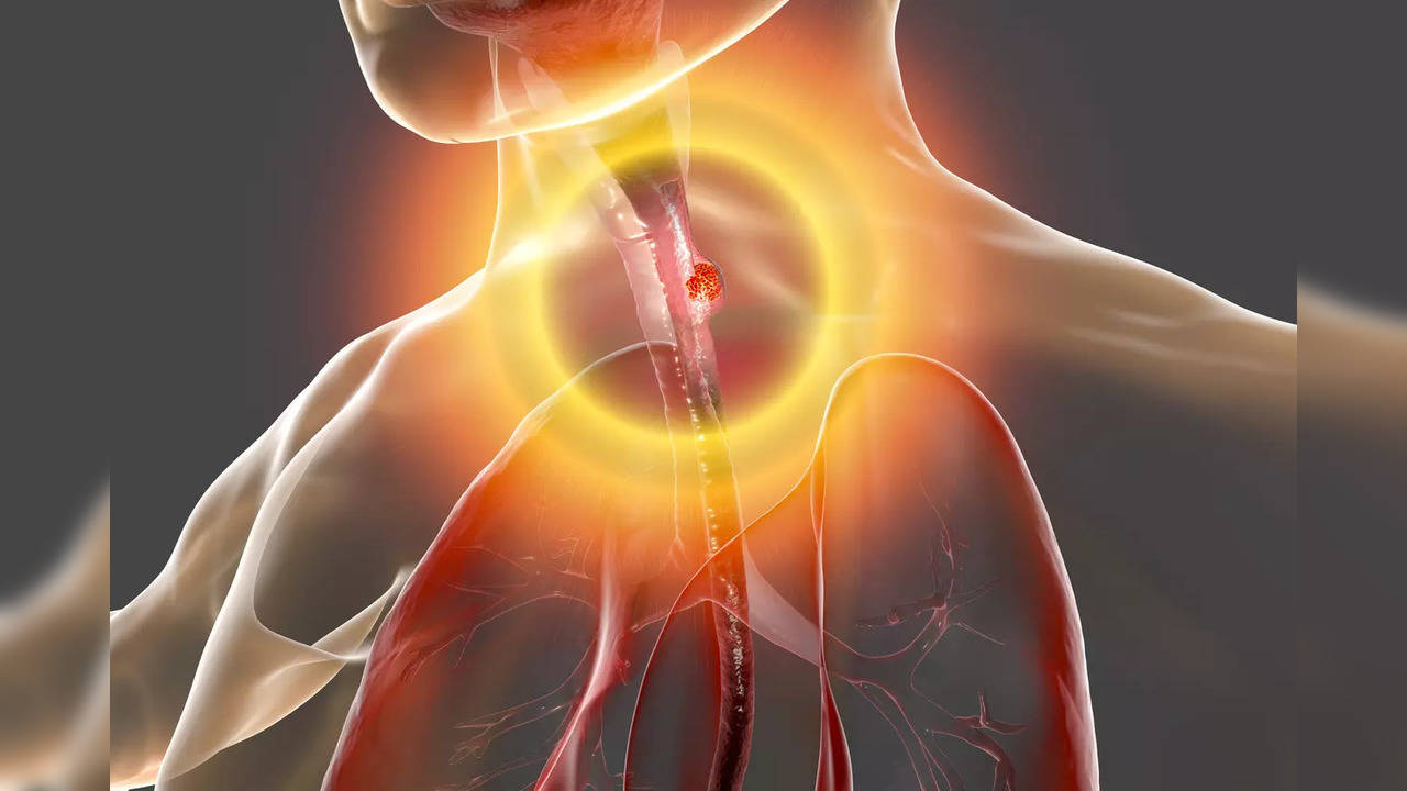 While mapping out the symptoms of this deadly disease, experts often notice that patients struggling with acidity of heartburn have a higher risk of certain forms of it – such as oesophageal cancer.