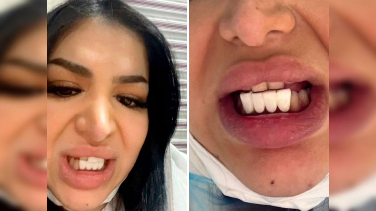 Botched dental op gives woman piano keys teeth