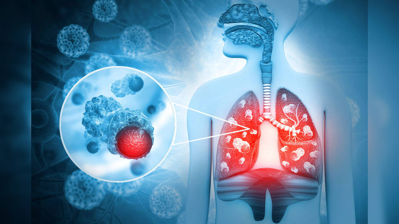 The liquid biopsy tests for a biomarker of PD-L1, a protein and targets a type of immunotherapy called checkpoint inhibitors, which helps the patient's immune system attack and kill cancer cells.