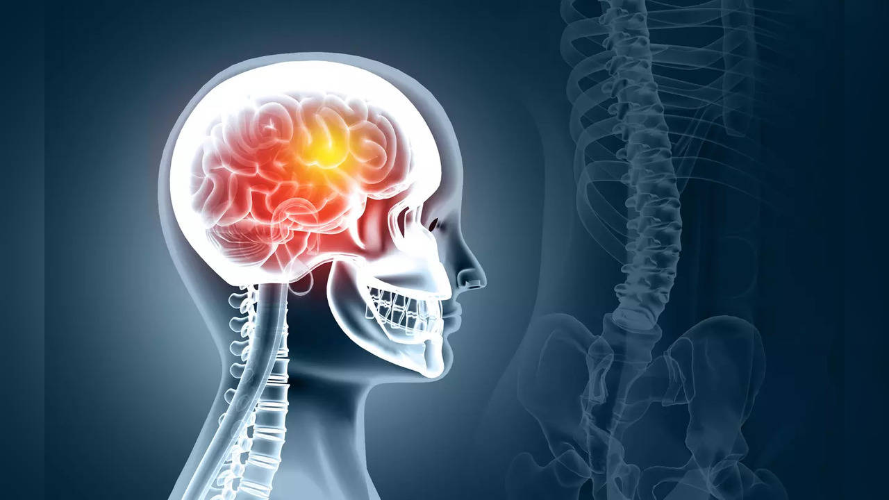 Can hormonal therapy raise brain tumour risk in women?