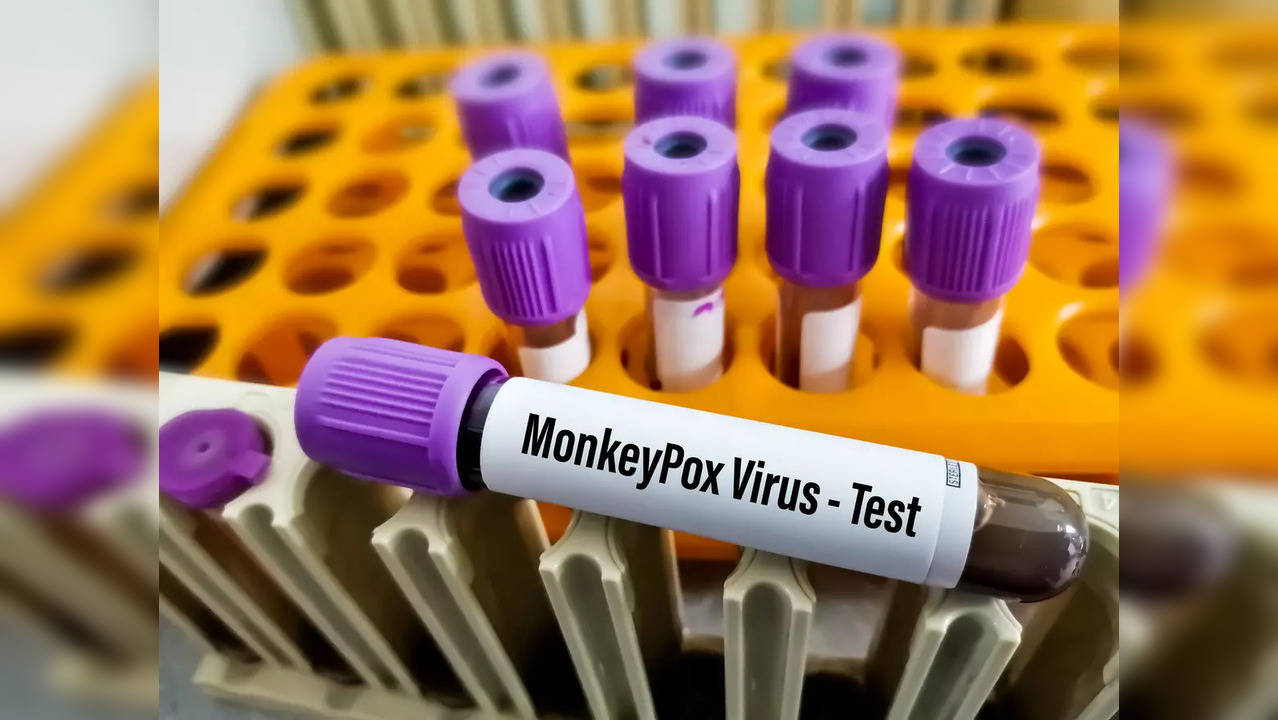 Monkeypox scare: Tips to avoid contracting the virus