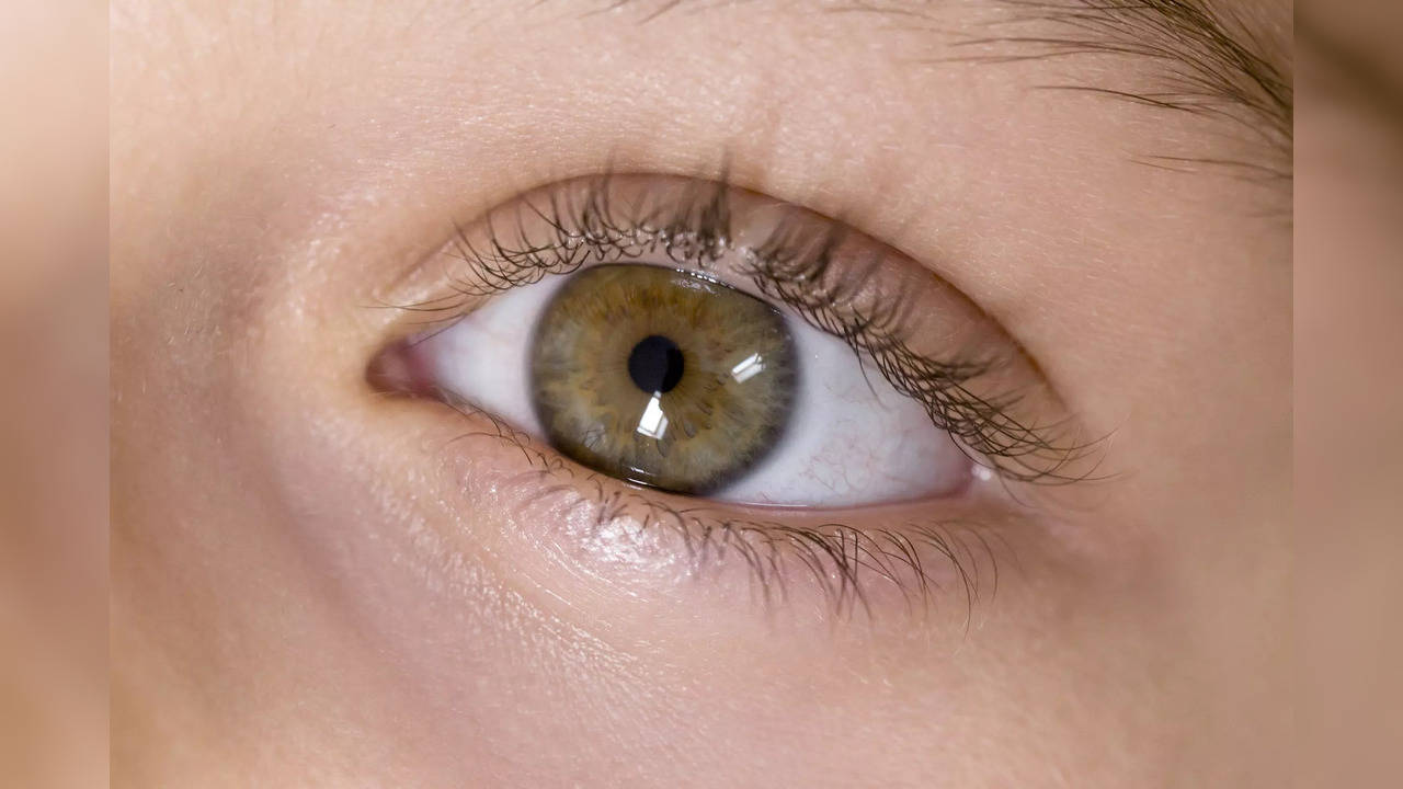 Cholesterol symptoms: 3 Warning signs of high cholesterol in your eyes |  The Times of India