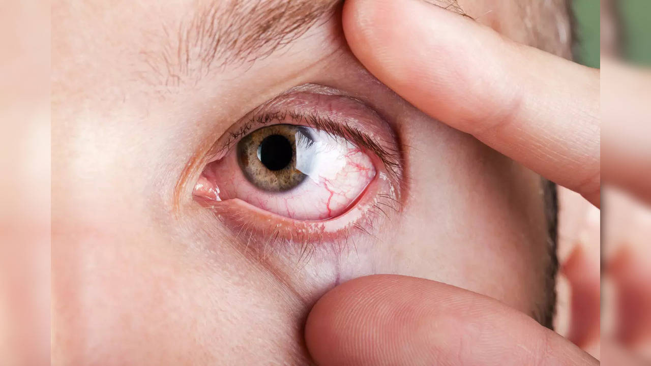 Diabetes and eye health: 3 ways this chronic condition affects the vision