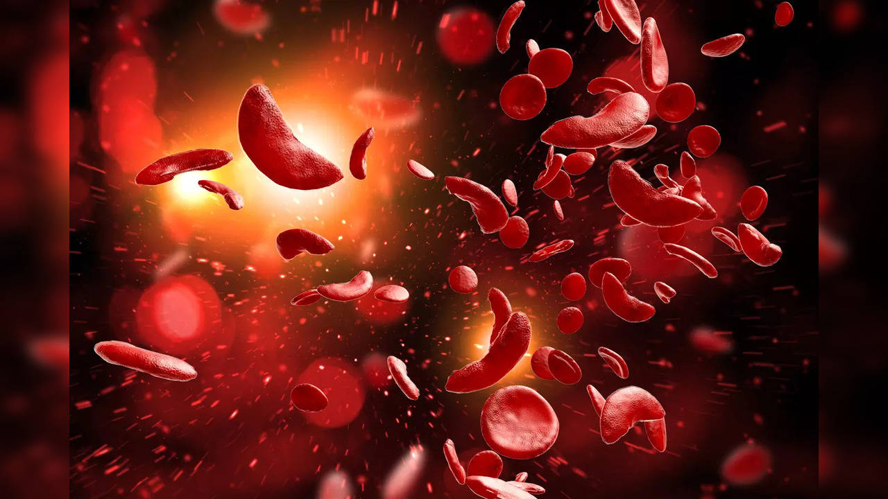 World Sickle Cell Day 2022: 3 common myths about the disease busted!