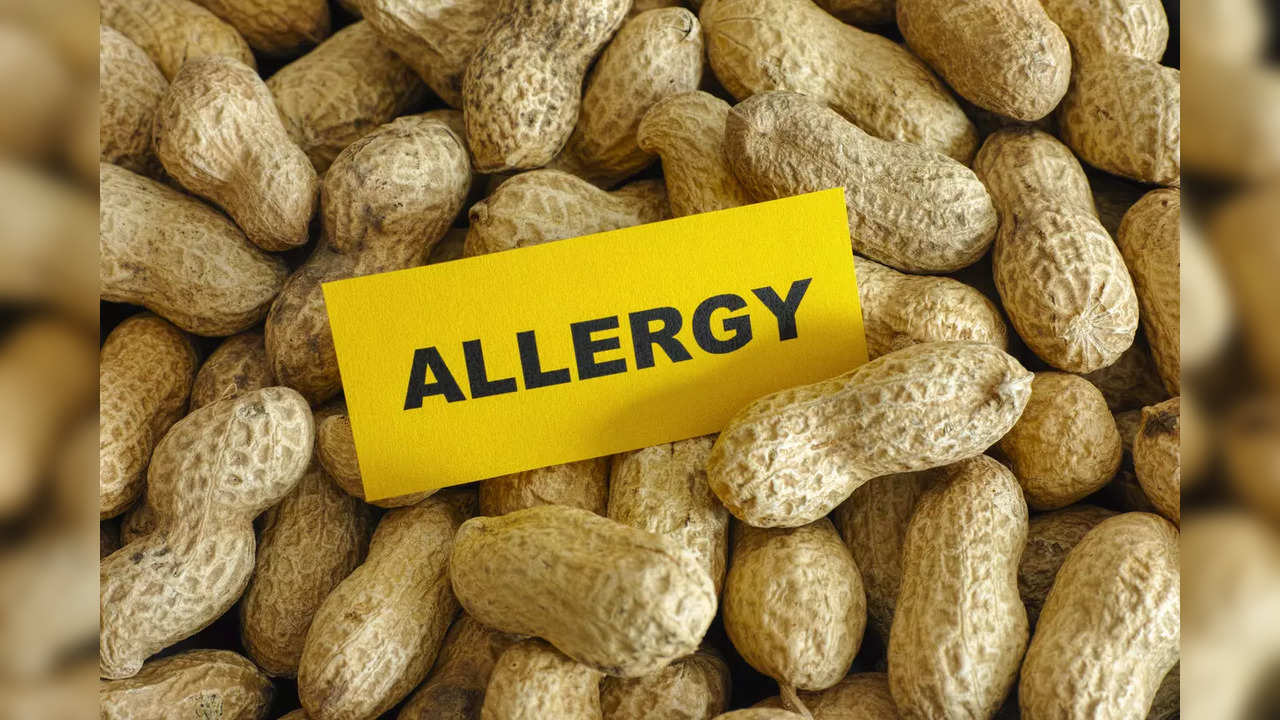 Peanut allergy treatment most effective when started early in infants: Study