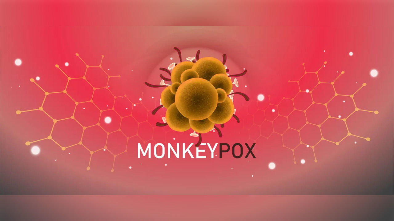 Monkeypox fever