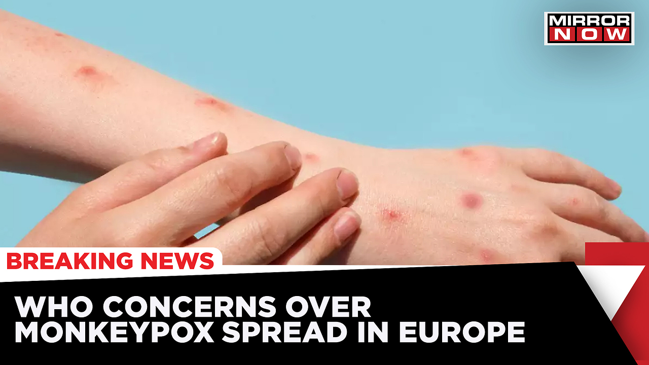 WHO Calls For Urgent Action For Monkeypox Spread In Europe | Times Now