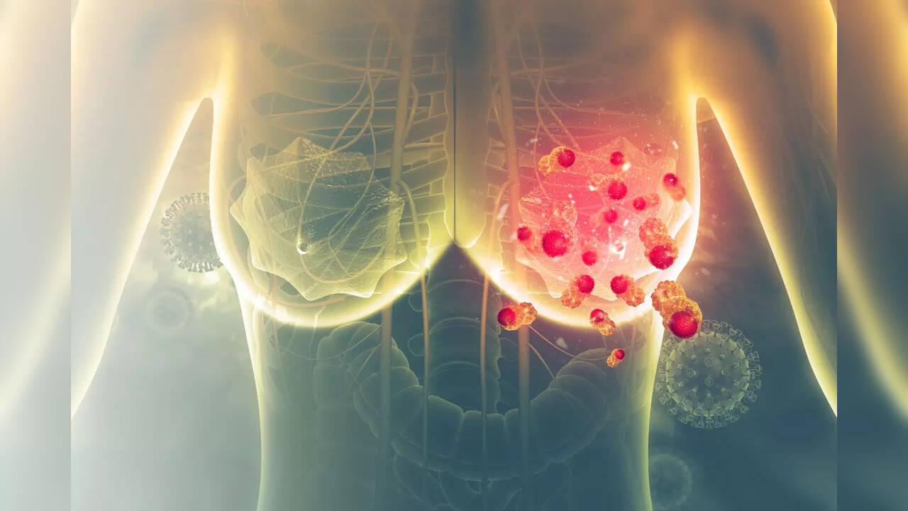 Unusual swelling in the breast? Could a sign of breast cancer, know the