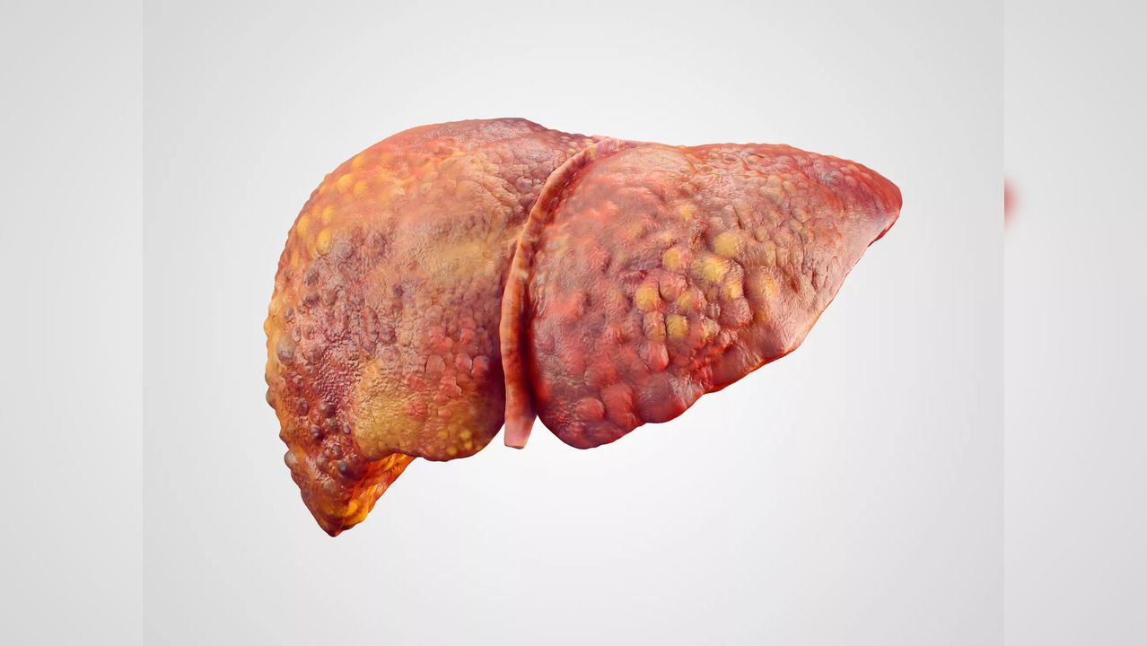 Experts therefore concluded that if one has fats in the liver, one will benefit from eating the right kind of fat.