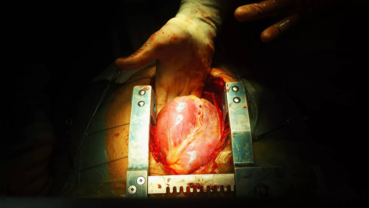 No signs of early rejection were observed in either organ and the hearts functioned normally with standard post-transplant medications and without additional mechanical support.