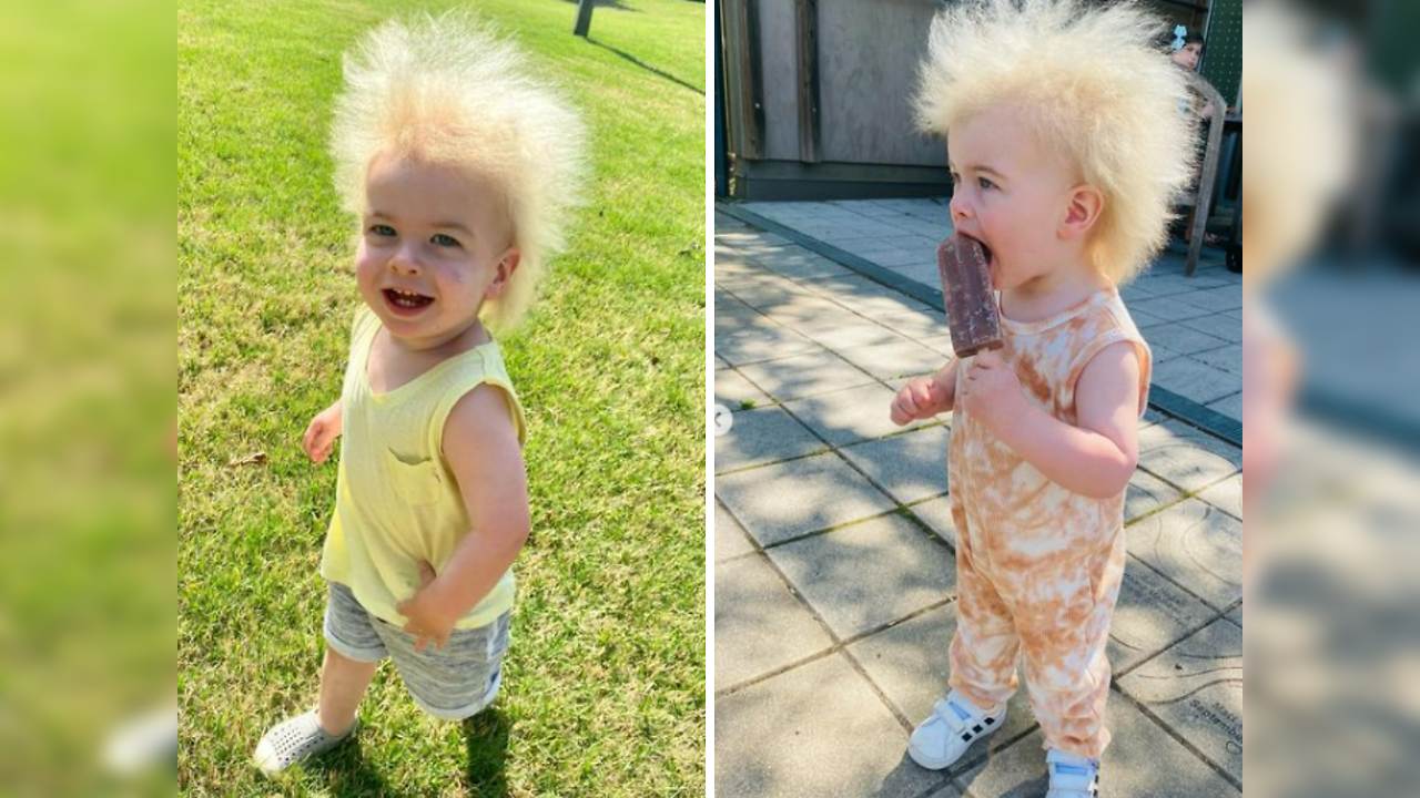 Scientists Find Cause Of ‚Uncombable Hair Syndrome‘ – JKAUL