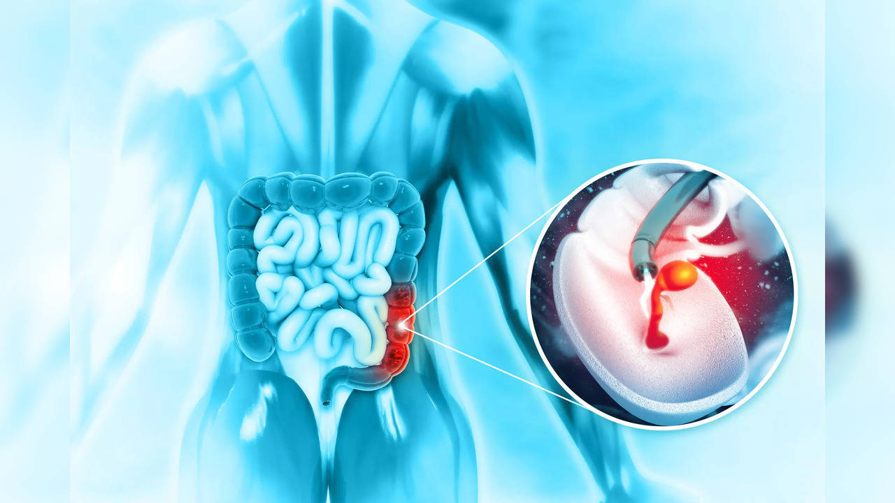 Once diagnosed with cancer, doctors recommend chemotherapy or radiotherapy depending on the severity of the tumour.