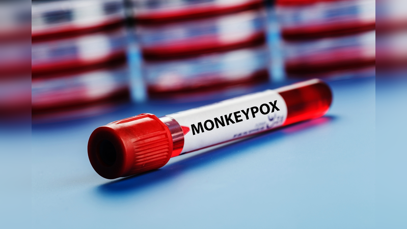 Centre invites proposals for developing Monkeypox vaccine