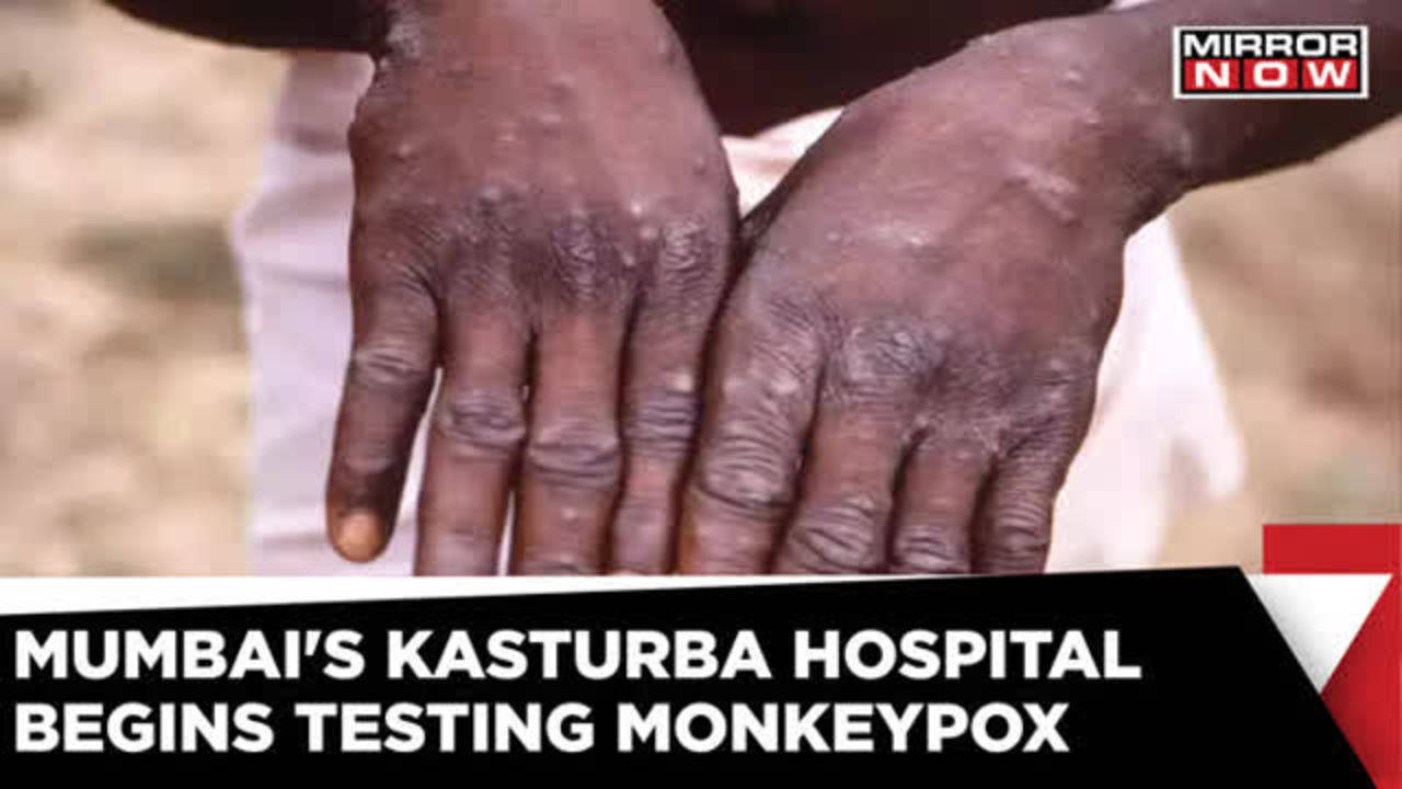 BMC's Kasturba Hospital Starts Testing Monkeypox; First In Mumbai ...