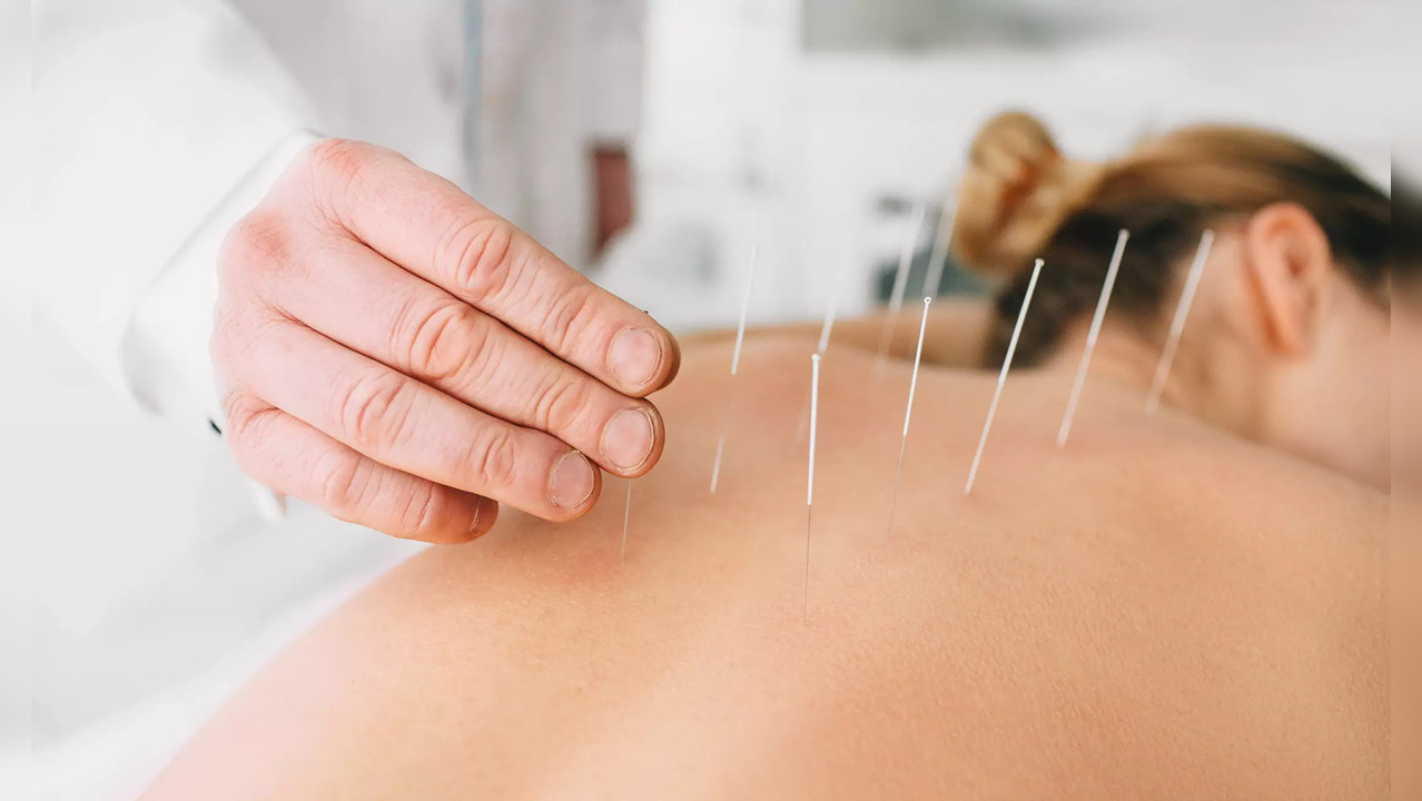 PhD candidate and lead researcher Min Zhang said this showed great promise for acupuncture therapy as an additional option to ward off diabetes, which is estimated to affect 11 per cent of the world's adult population.