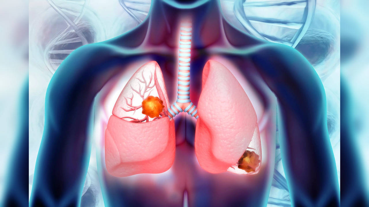 Lung cancer is a deadly disease that starts in this key organ of the respiratory system and smoking is the key driving factor.