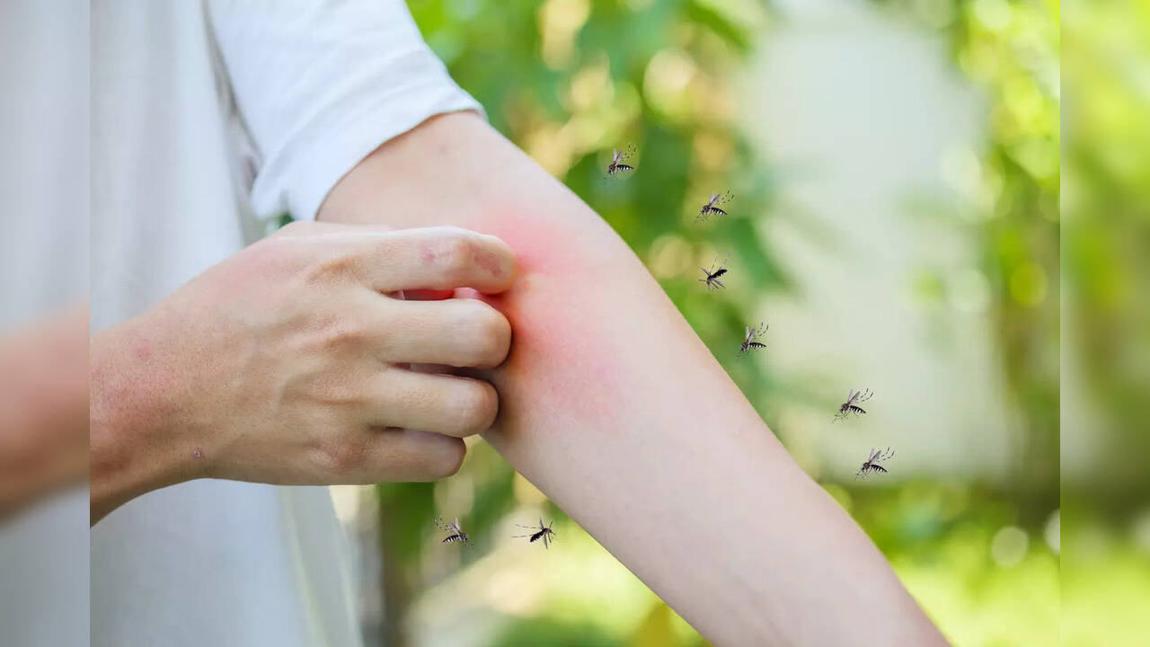 Do mosquitoes bite you more than others? Find out what makes you more