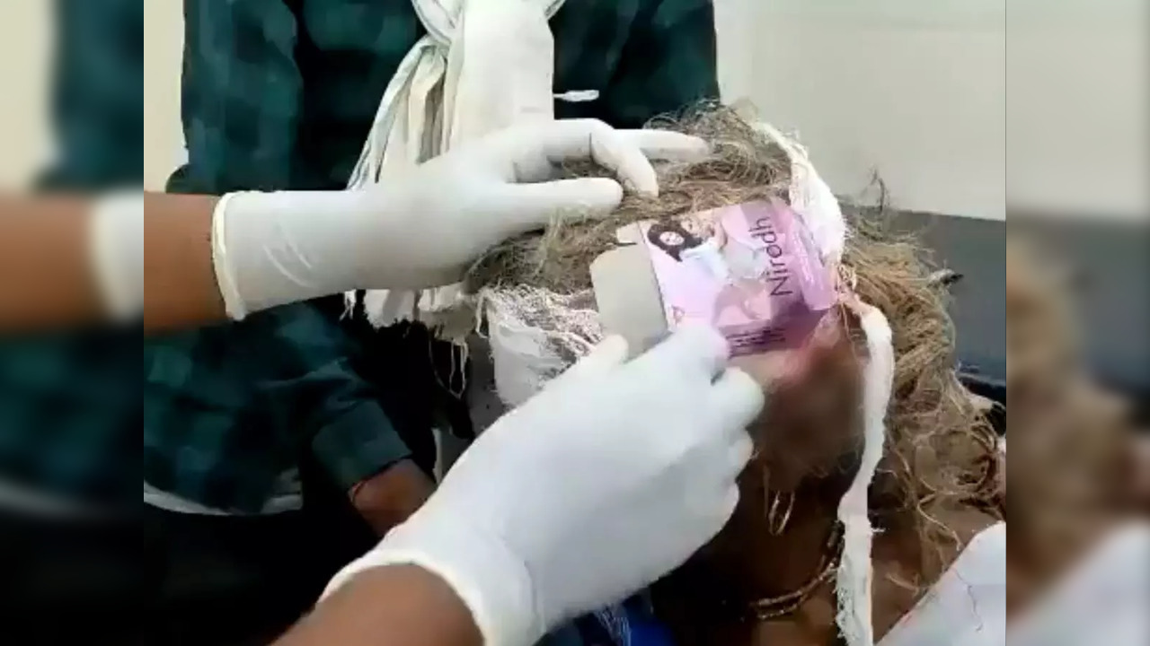 A ward boy at a community health centre in MP used a condom pack to dress a woman's head injury