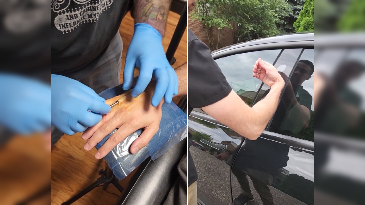 YouTuber testing his Tesla car key chip implant