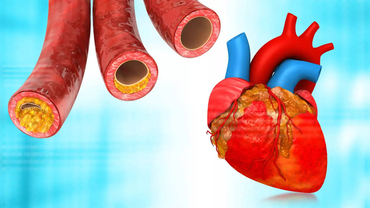 cholesterol