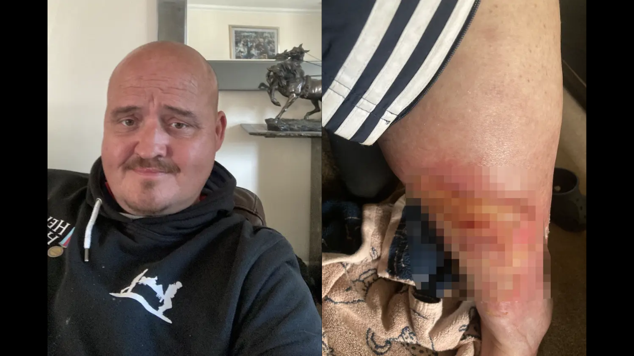 Man thought his drink was spiked in pub - but he was bitten by spider