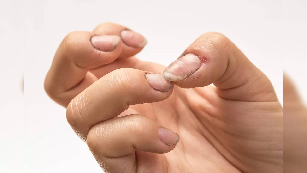 What do healthy nails look like?