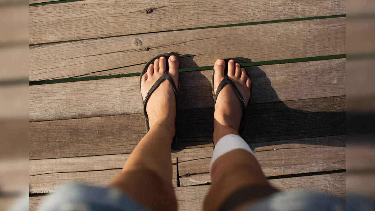 The cost of comfort - Know how flip-flops can affect your feet