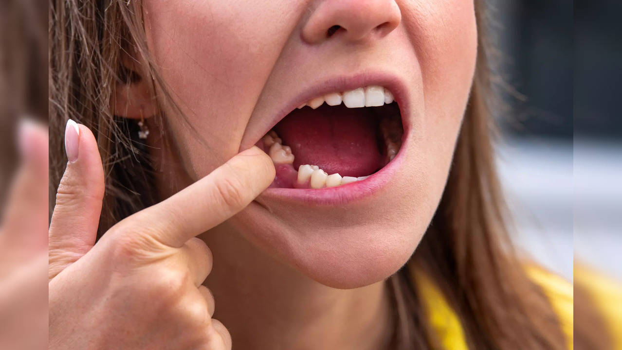 Experts noted that women and younger people were more prone to poor oral health.