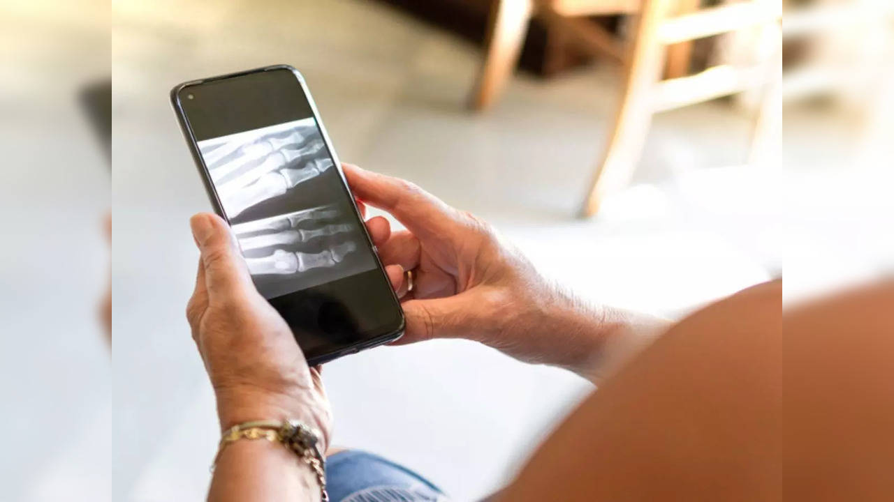 Punjab: A government hospital in Patiala cites shortage of X-ray films as its reason to only allow patients with smartphones to get diagnosed | Representative image