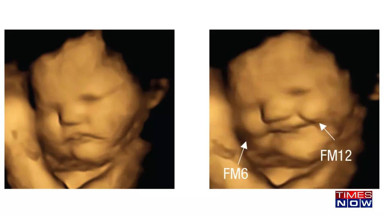 4D ultrasound shows facial expressions of babies reacting to taste and