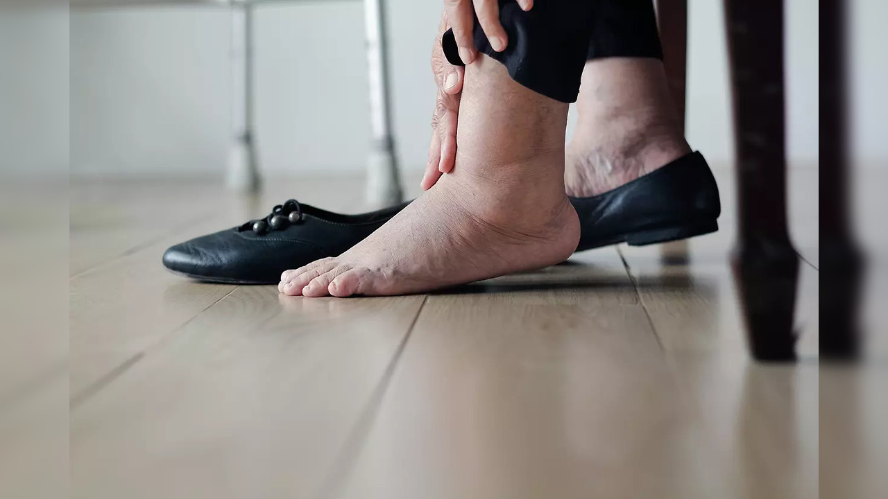 Do your feet get swollen when you sit for long hours? Here are the ...