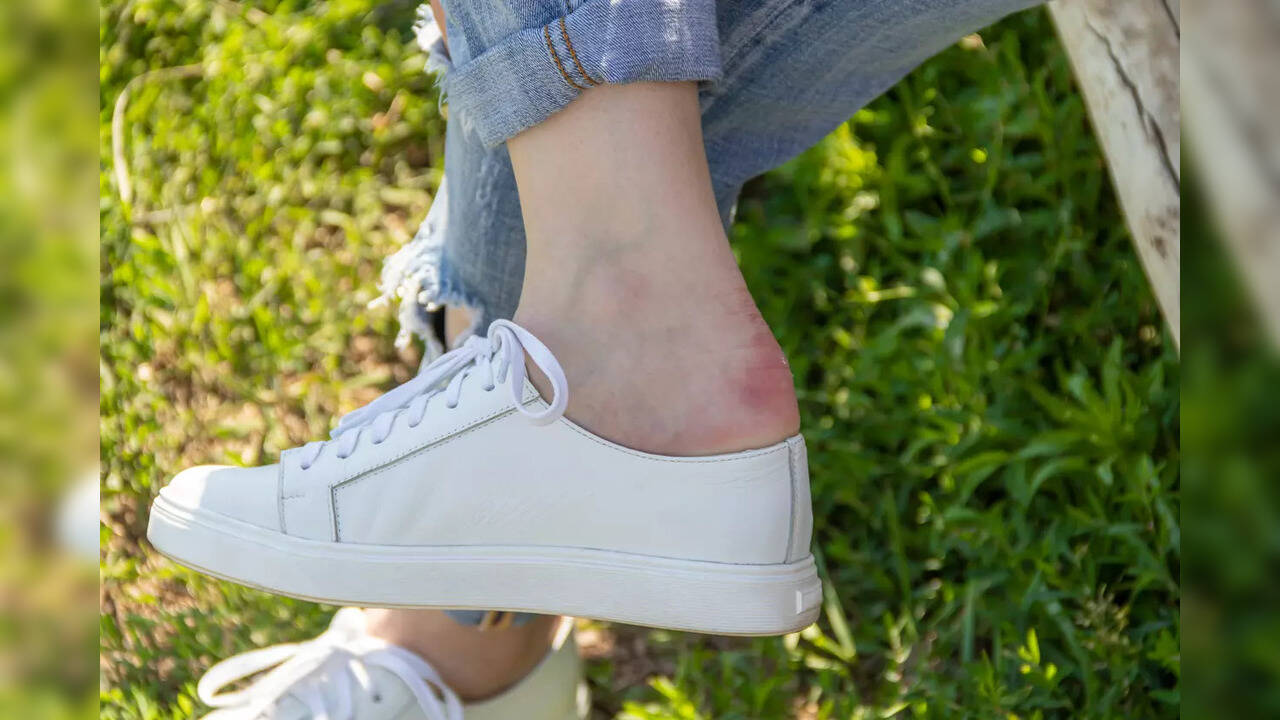 Know what could be causing blisters between your toes Health News