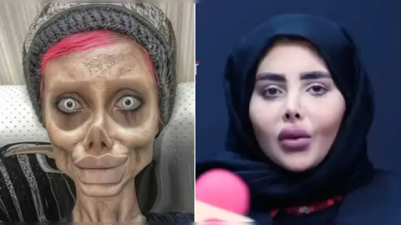 Iranian 'Zombie Angelina Jolie' looked like a normal girl in a TV