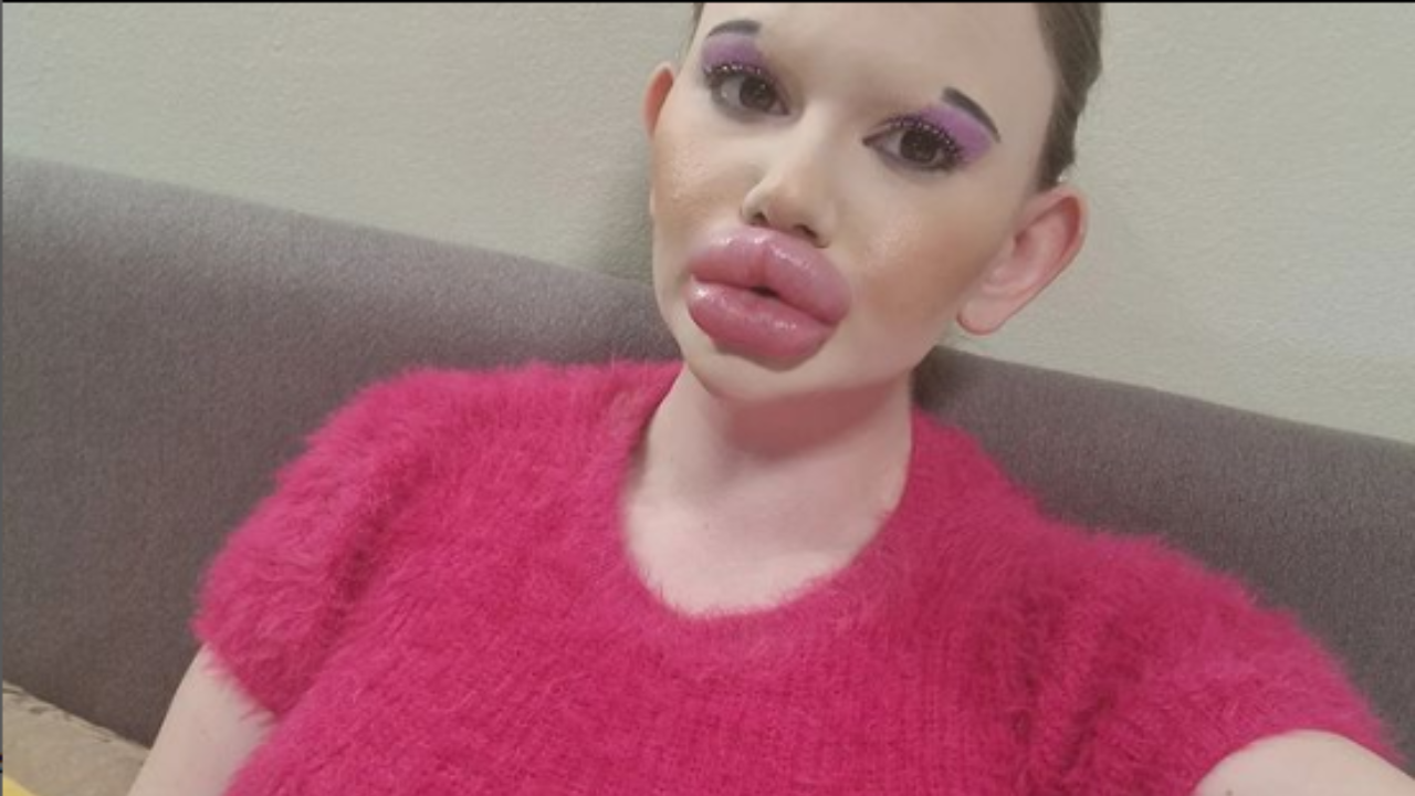 Andrea Ivanova Woman With World S Biggest Lips Has Spent Rs Lakh