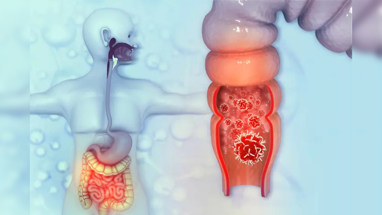 A novel experimental mouse model that mimics the process patients go through when they relapse has been created by scientists.