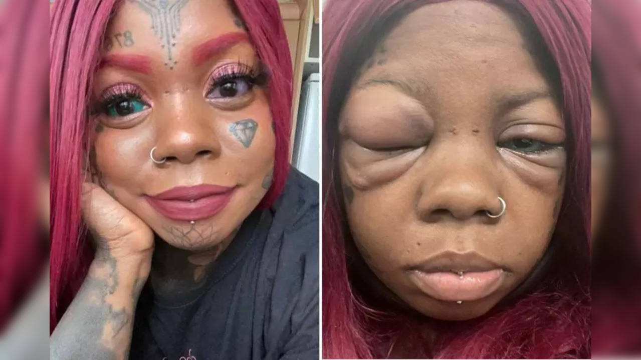 Model's eye tattoo could now leave her blind | whas11.com