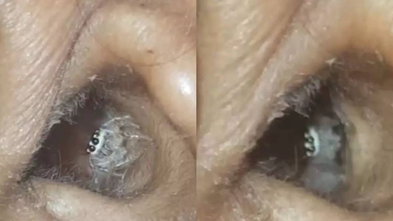 Spider walks out of a woman's ear, netizens shocked [WATCH]