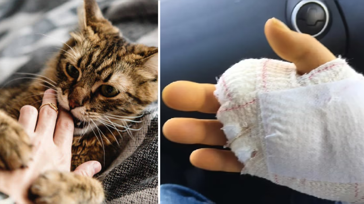 Can cat bites turn fatal? Man dies four years after being bitten by his