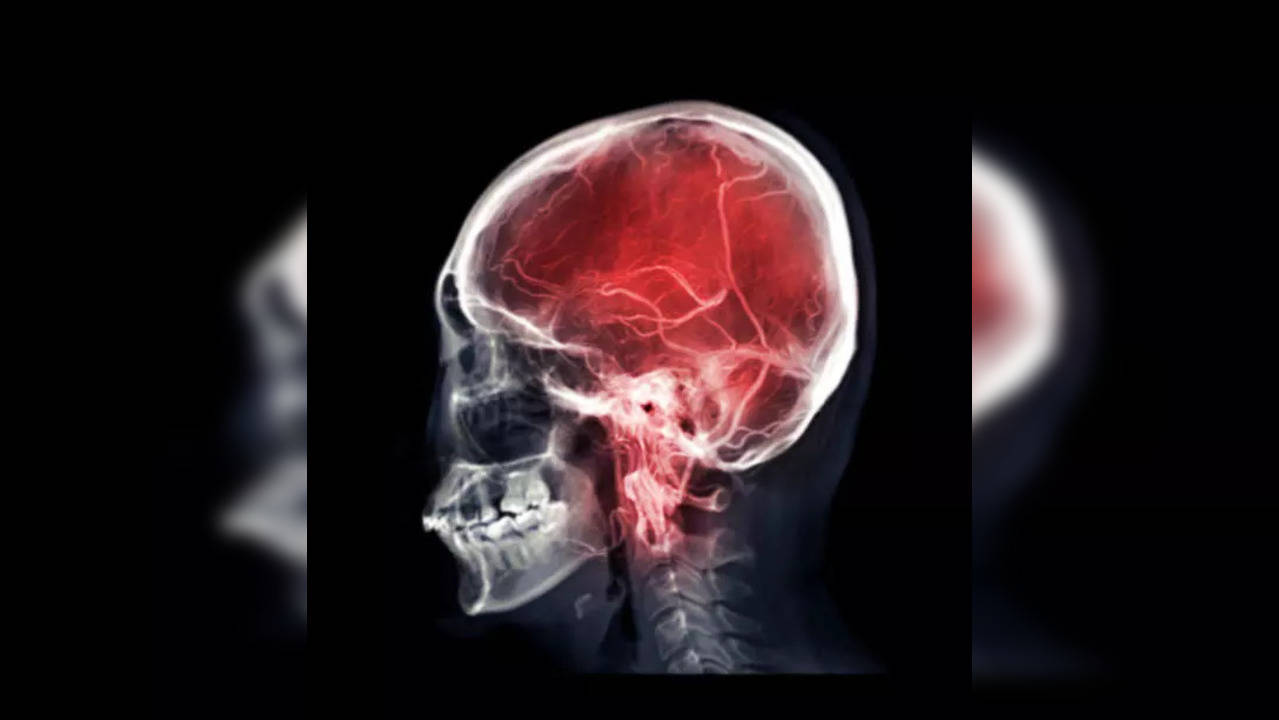 hepatic encephalopathy