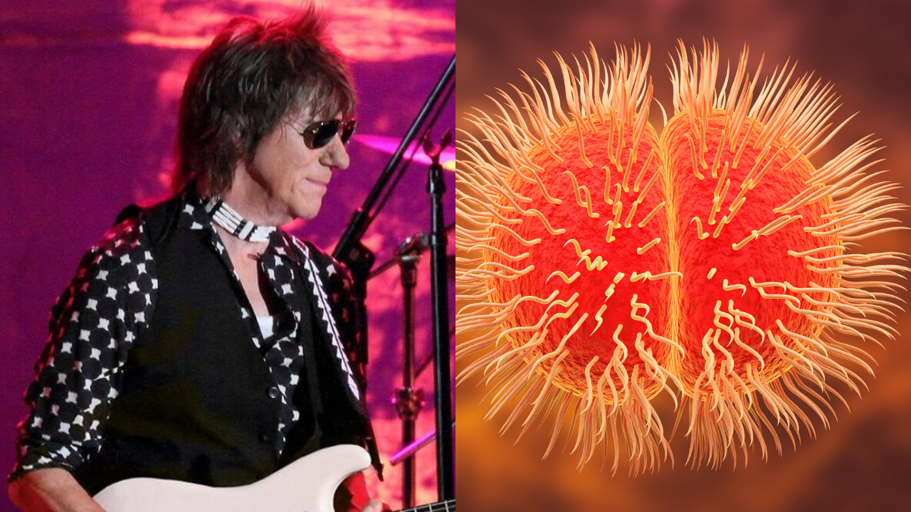 Bacterial-meningitis-jeff-beck