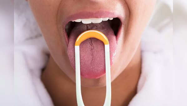 What does the colour of your tongue mean? Experts reveal how it could