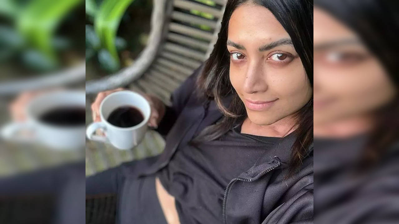 Malayalam actress Mamta Mohandas on Sunday revealed that she is suffering from an autoimmune illness known as vitiligo – she made the revelation on Instagram with a picture of herself and a poem. (Photo credit: Mamta Mohandas/Instagram)