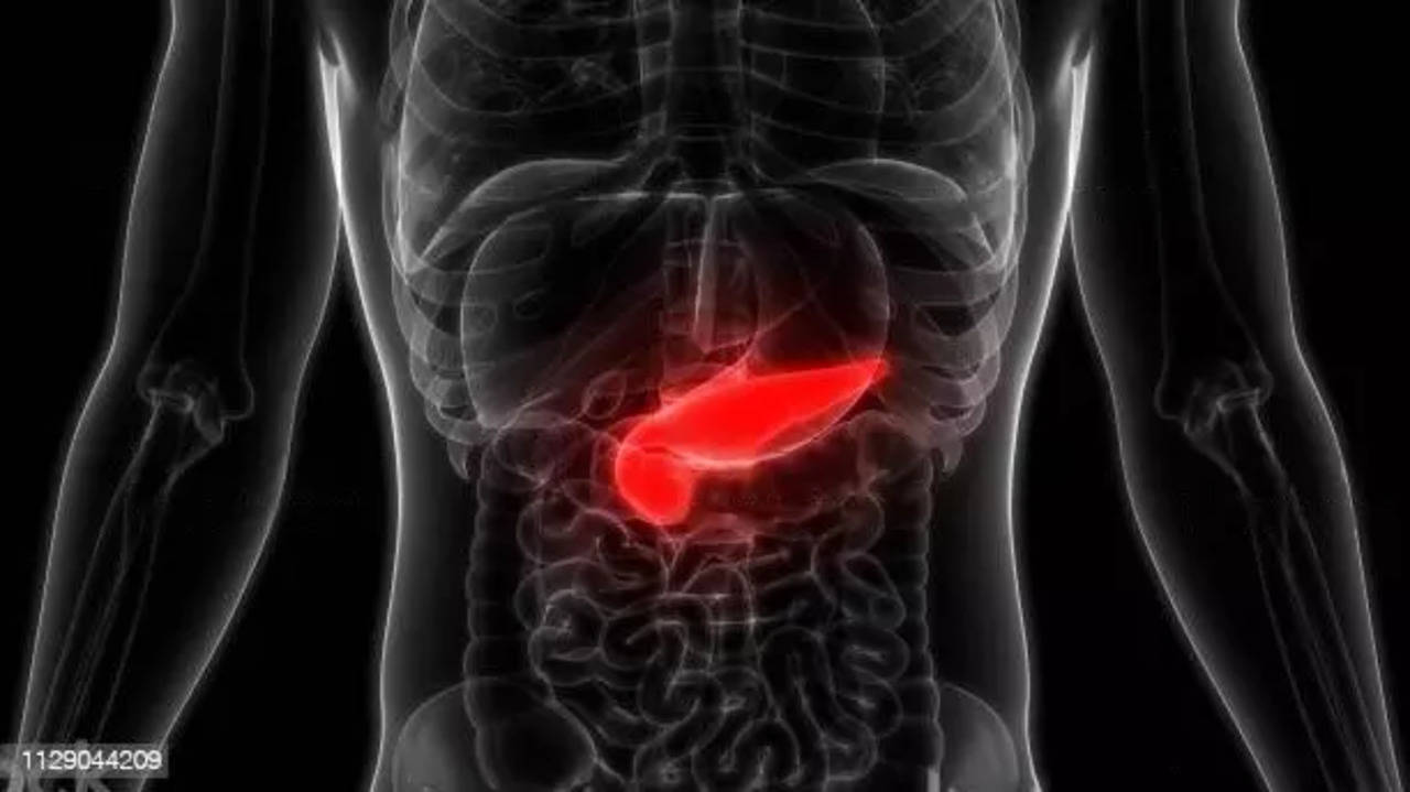 Pancreatic cancer: Signs and symptoms